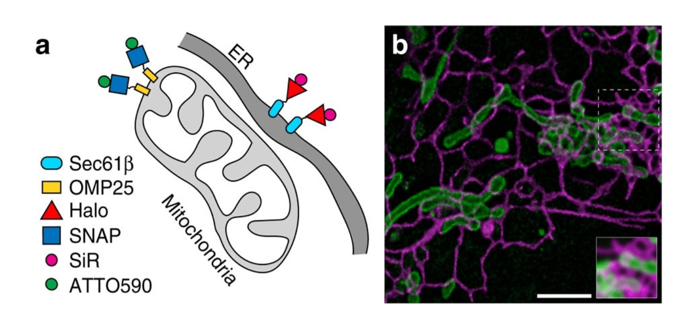 图2:对内质网和线粒体进行双色超分辨率成像,揭示了动态细胞器相互作用。