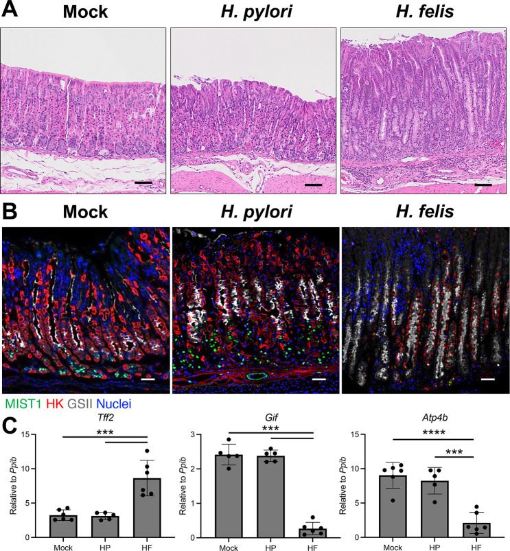 Helicobacter_pylori_and_Helicobacter_felis_3