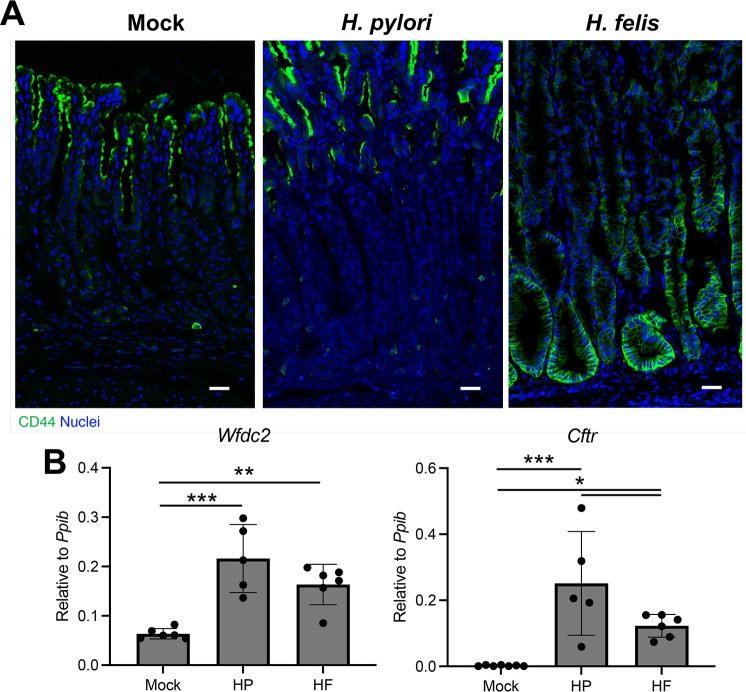 Helicobacter_pylori_and_Helicobacter_felis_4