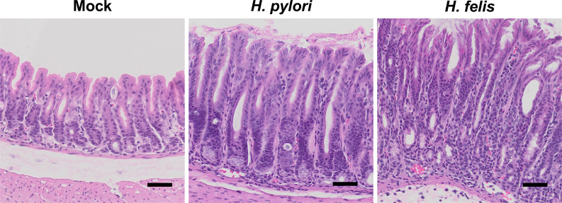 Helicobacter_pylori_and_Helicobacter_felis_5