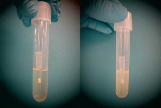 无细菌生长的培养基(左)与有细菌生长的培养基(右)