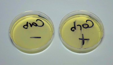 阴性结果2：两种菌株均未生长
