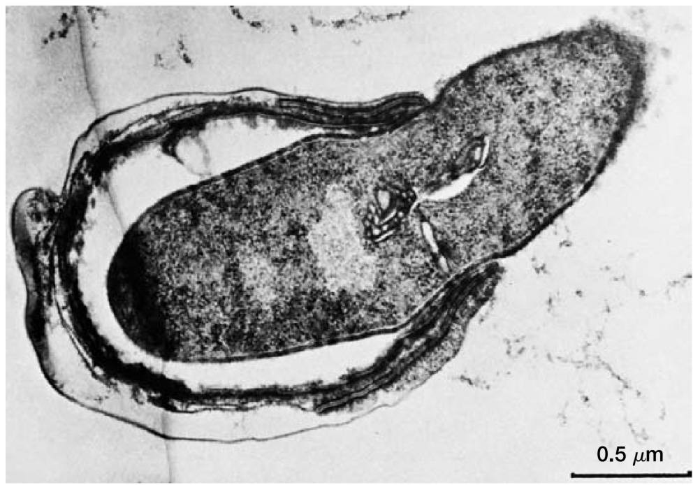芽孢萌发 (Endospore Germination)。果胶梭菌 (Clostridium pectinovorum)