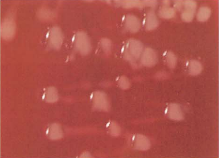 图 1黏液型菌落:马红球菌(96h)