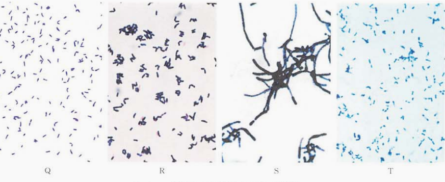 图 2.革兰阳性杆菌的镜下形态(革兰染色)
A.硬质小麦棒杆菌;B.李斯特菌;C.厄氏菌;D.耳炎苏黎世菌;E.刚果嗜皮菌;F.小单胞菌;G红斑丹毒丝菌;H.马红球菌;I.马杜拉马杜拉放线菌;J.星形诺卡菌;K.化肤隐秘杆菌/溶血隐秘杆菌;L.支气管戈登菌;M.耐酪氨酸冢村菌;N.紫红链霉菌;O.人皮肤杆菌:P.海洋迪茨菌;Q.白喉棒杆菌;R假白喉棒杆菌;S.马氏棒杆菌;T.阴道加特纳菌