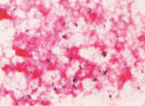 图 11 产单核细胞李斯特菌血培养标本的涂片(革兰染色)