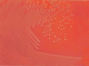 图 12 产单核细胞李斯特菌在血琼脂平板上的菌落特征(18~24 h)