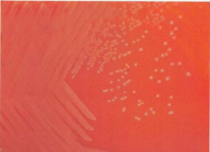 图 13 产单核细胞李斯特菌在血琼脂平板上的菌落特征(>48h)