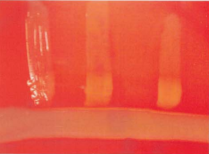 图 16 产单核细胞李斯特菌CAMP试验阳性