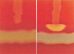 图 17 李斯特菌与无乳链球菌