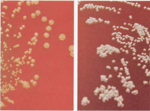 图 10星形诺卡菌在血琼脂平板上的菌落特征(72h,左图黄色,右图白色)