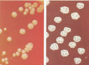 图 11星形诺卡菌在血琼脂平板上的菌落特征(96h.左图黄色,右图白色)