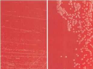 图 12 星形诺卡菌与链霉菌菌落大小的鉴别左图为星形诺卡菌;右图为链霉菌