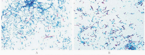 图 13 血琼脂平板上培养48h星形诺卡菌的菌落涂片做抗酸染色A.用盐酸乙醇脱色≤30s:B 用1%H2SO4脱色至菌膜无色为止