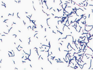 图 14巴西诺卡菌纯培养的镜下形态(革兰染色,18~24h)
