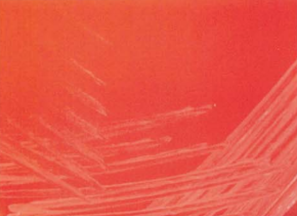 图 15巴西诺卡菌在血琼脂平板上的菌落特征(18~24h)