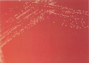 图 16巴西诺卡菌在血琼脂平板上的菌落特征(48h)