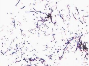 图 18豚鼠耳炎诺卡菌纯培养的镜下形态(革兰染色,72h)