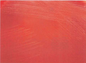 图 19豚鼠耳炎诺卡菌在血琼脂平板上的菌落特征(18~24h)