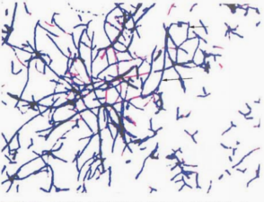图 1星形诺卡菌纯培养的镜下形态(革兰染色,18~24h)