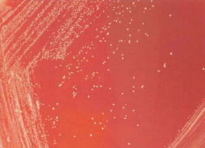 图 20豚鼠耳炎诺卡菌在血琼脂平板上的菌落特征(48h)