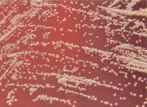 图 21豚鼠耳炎诺卡菌在血琼脂平板上的菌落特征(72h)