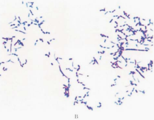 图 22 皮氏诺卡菌纯培养的镜下形态A.革兰染色.18~24h;B弱抗酸染色,48h