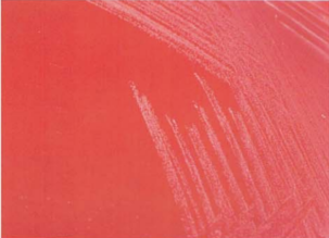 图 24 皮氏诺卡菌在血琼脂平板上的菌落特征(18~24h)