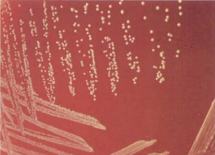 图 25 皮氏诺卡菌在血琼脂平板上的菌落特征(48h)