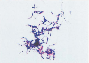 图 2 星形诺卡菌纯培养的镜下形态(革兰染色,48h)