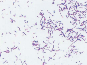 图 3 星形诺卡菌纯培养的镜下形态(革兰染色,96h)