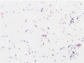 图 4星形诺卡菌纯培养的镜下形态(革兰染色,120h)