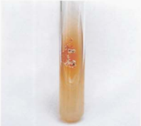 图 6 星形诺卡菌在SDA上的菌落特征(5~7日)