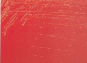 图 7星形诺卡菌在血琼脂平板上的菌落特征(24h)