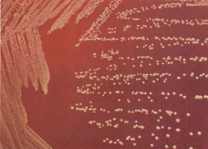 图 8星形诺卡菌在血琼脂平板上的菌落特征(48h)