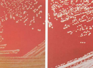 图 9星形诺卡菌在血琼脂平板上的咬琼脂现象(48h,左图黄色,右图白色)