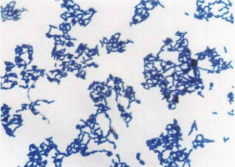 图 5硬质小麦棒杆菌纯培养的镜下形态(革兰染色)
