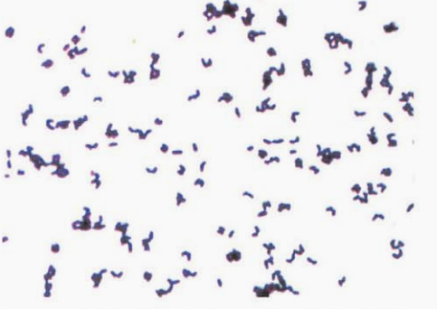 图 6纹带棒杆菌在血琼脂平板上纯培养镜下形态(革兰染色)