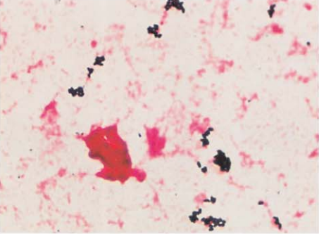 图 8 含树脂血培养瓶涂片(革兰染色)