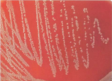 图 9纹带棒杆菌在血琼脂平板上菌落特征(18~24h)