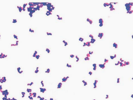 图 10杰氏棒杆菌在血琼脂平板上纯培养镜下形态(革兰染色)