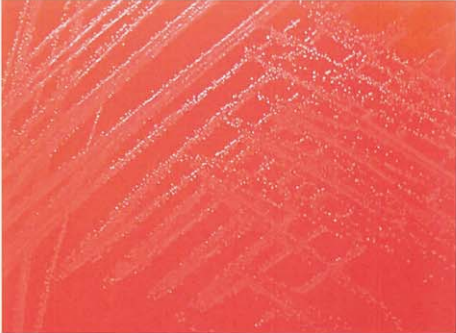 图 11杰氏棒杆菌在血琼脂平板上菌落特征(18~24h)