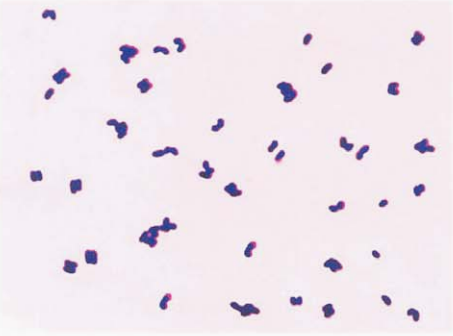 图 12解脲棒杆菌在血琼脂平板上纯培养的镜下形态(革兰染色)