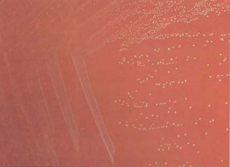 图 13解脲棒杆菌在血琼脂平板上的菌落特征(18~24h)