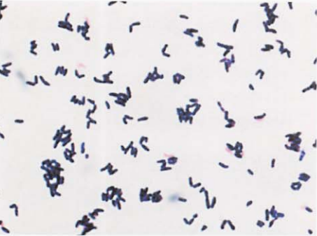 图 1假白喉棒杆菌纯培养物的镜下形态(革兰染色)