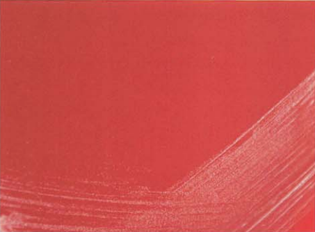 图 2假白喉棒杆菌在血琼脂平板上的菌落特征(24h)