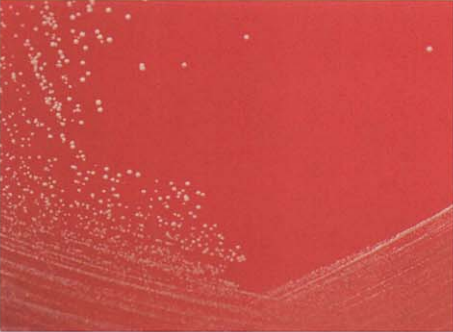 图 3假白喉棒杆菌在血琼脂平板上的菌落特征(48h)