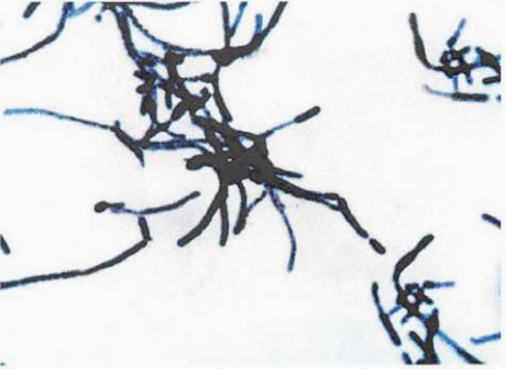图 4 马氏棒杆菌纯培养镜下形态(革兰染色)