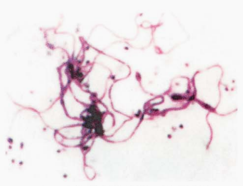 图 1小单孢菌属纯培养的镜下形态(革兰染色)