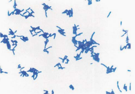 图 2耳炎苏黎世菌纯培养镜下形态(革兰染色)